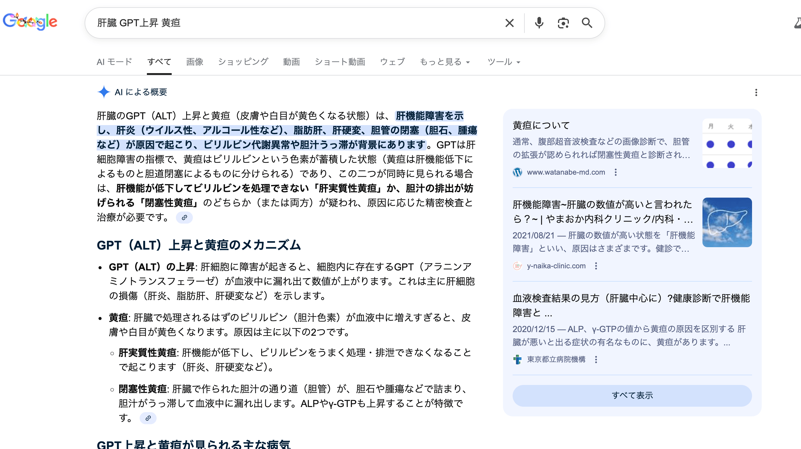 AI Overviewイメージ